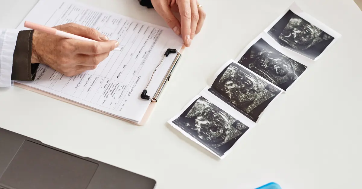 AMH testing for infertility shown by a doctor reviewing ultrasound images and patient information on a clipboard.